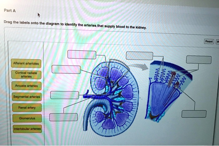 SOLVED: Drag the labels onto the diagram to identify the arteries that ...