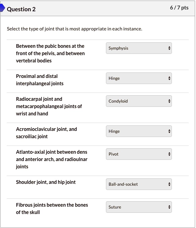 Select the type of joint that is most appropriate in each instance.
Between the pubic bones at the front of the pelvis, and between vertebral bodies Symphysis
Proximal and distal interphalangeal joints Hinge
Radiocarpal joint and metacarpophalangeal joints of wrist and hand Condyloid
Acromioclavicular joint, and sacroiliac joint Hinge
Atlanto-axial joint between dens and anterior arch, and radioulnar joints Pivot
Shoulder joint, and hip joint Ball-and-socket
Fibrous joints between the bones of the skull Suture