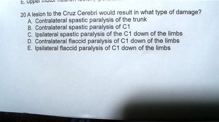 20 A lesion to the Cruz Cerebri would result in what type of damage?
A. Contralateral spastic paralysis of the trunk
B. Contralateral spastic paralysis of C1
C. Ipsilateral spastic paralysis of the C1 down of the limbs
D. Contralateral flaccid paralysis of C1 down of the limbs
E. Ipsilateral flaccid paralysis of C1 down of the limbs
