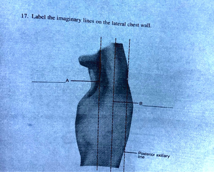 SOLVED 17. Label the imaginary lines on the lateral chest wall