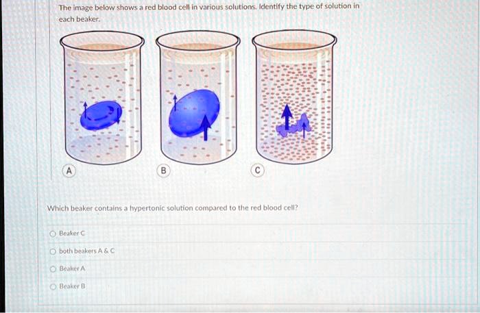 Please Help The Image Below Shows A Red Blood Cell In Various Solutions ...