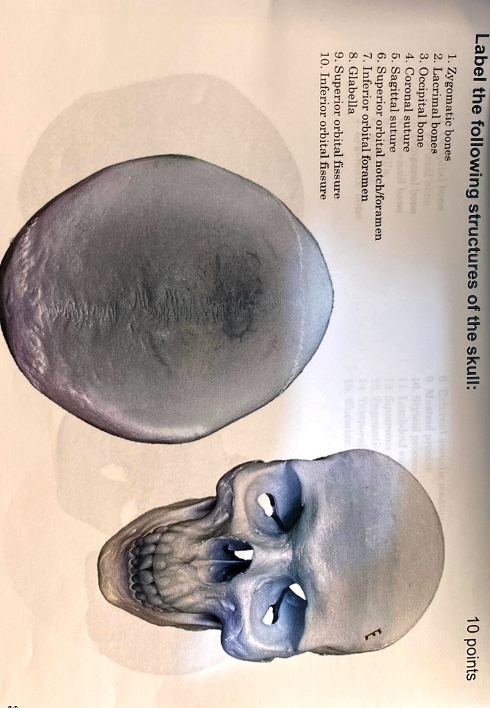 Label the following structures of the skull: 10 points Zygomatic bones ...