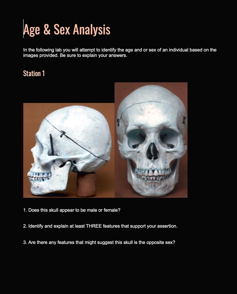 SOLVED: Age Sex Analysis In the following lab you will attempt to identify  the age and or sex of an individual based on the images provided. Be sure  to explain your answers.