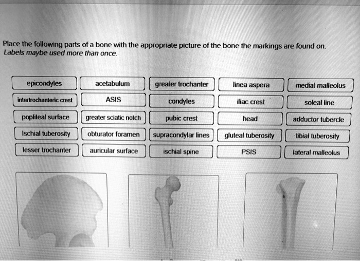 bone markings tuberosity