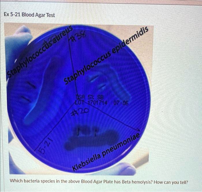 SOLVED Ex 521 Blood Agar Test Staphylococcus epidermidis TSALSGISB