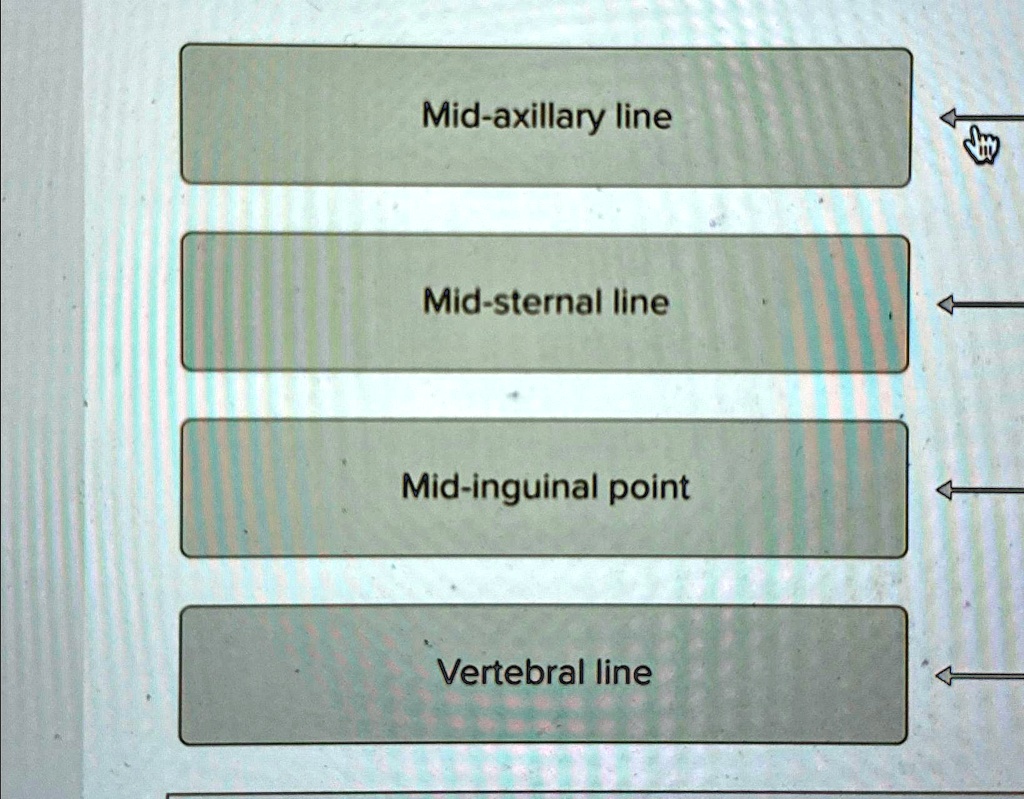 Mid-axillary line Mid-sternal line Mid-inguinal point Vertebral line ...