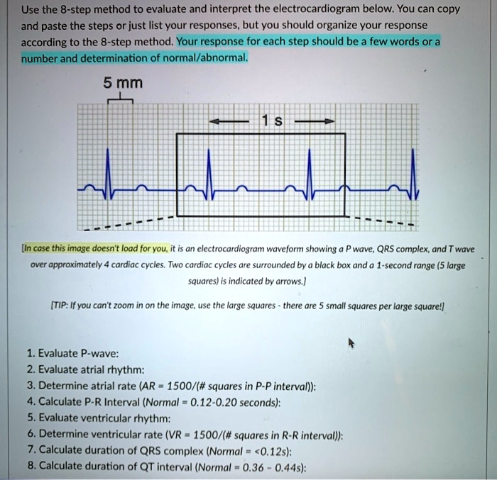 Small Boxes On Ecg | informacionpublica.svet.gob.gt