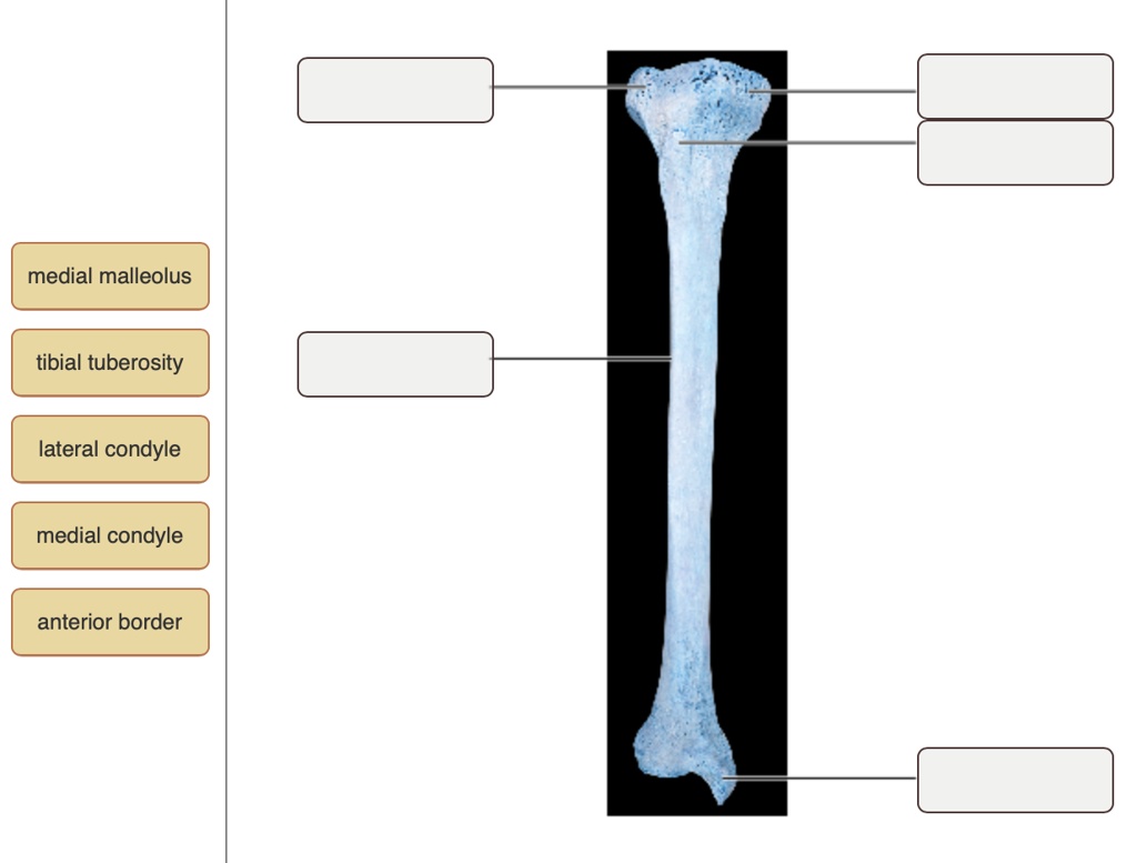 SOLVED medial malleolus tibial tuberosity lateral condyle medial