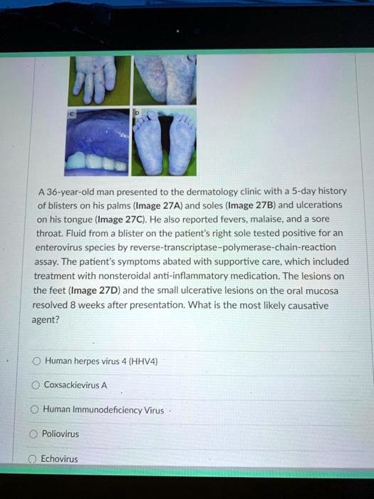 SOLVED:A 36-vear-old man presented to the dermatalogy clinic with a 5 ...