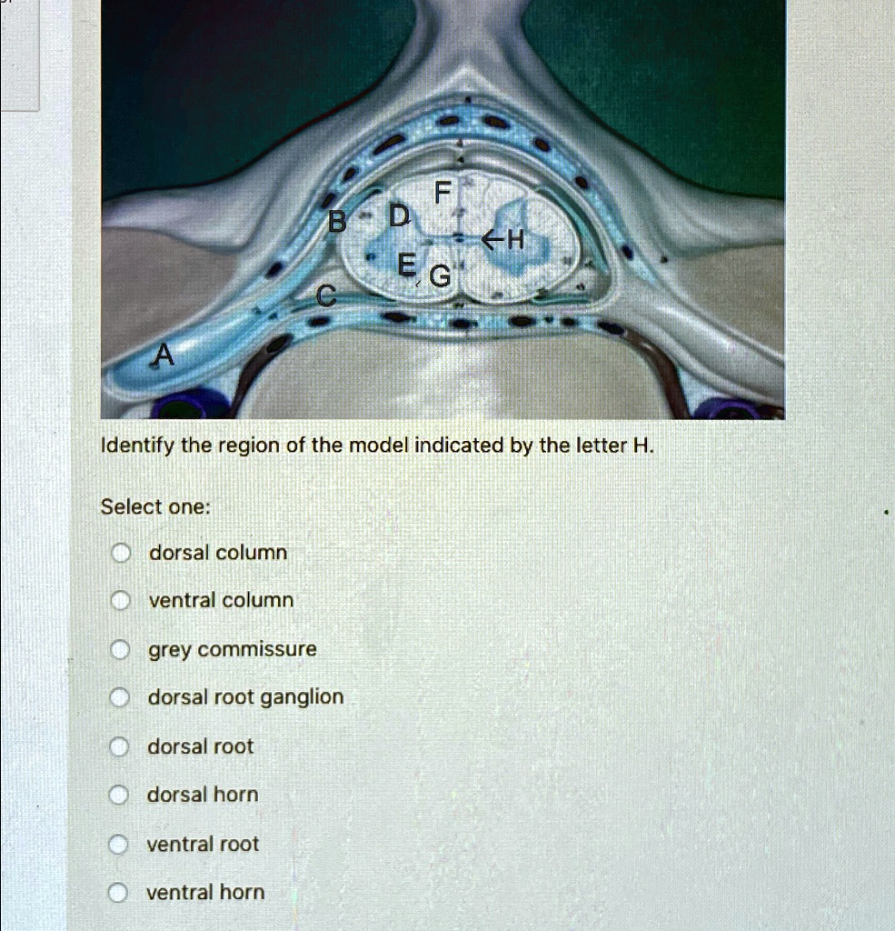 Identify the region of the model indicated by the letter H. Select one ...