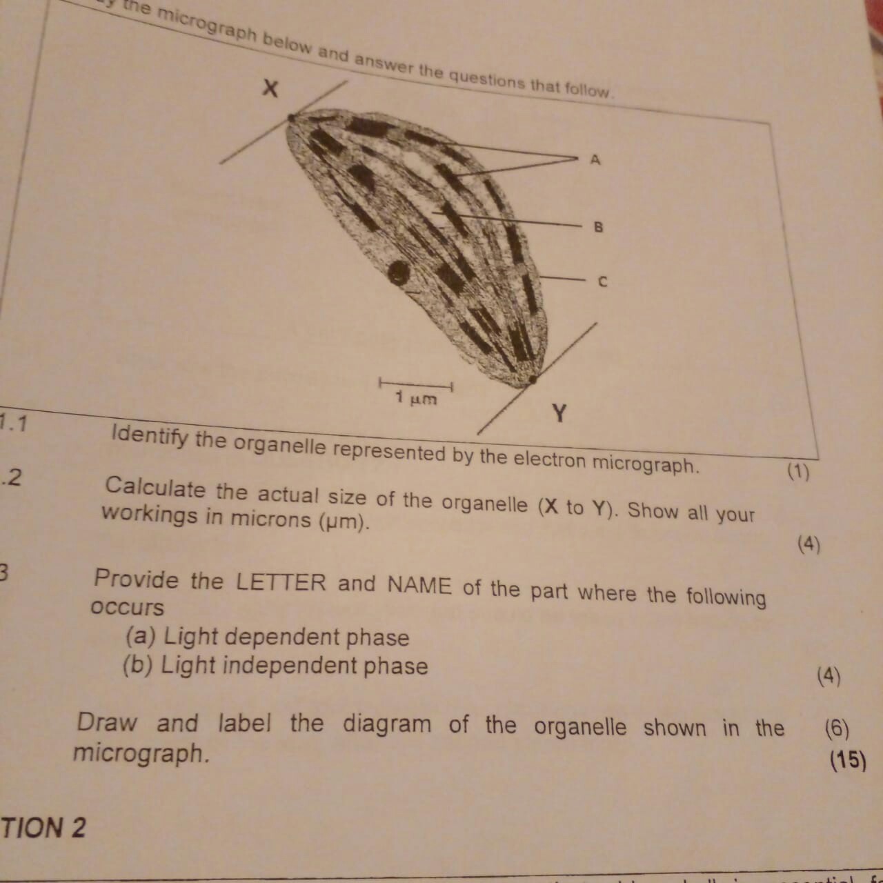 SOLVED: the micrograph below and answer the questions that follow ...