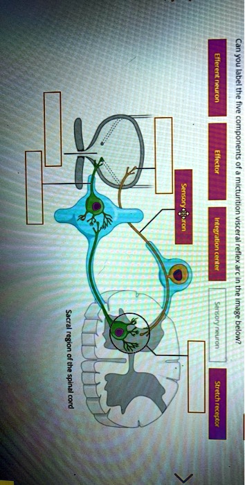 SOLVED: Efferent neuron, Effector, Sensory neuron. Can you label the ...