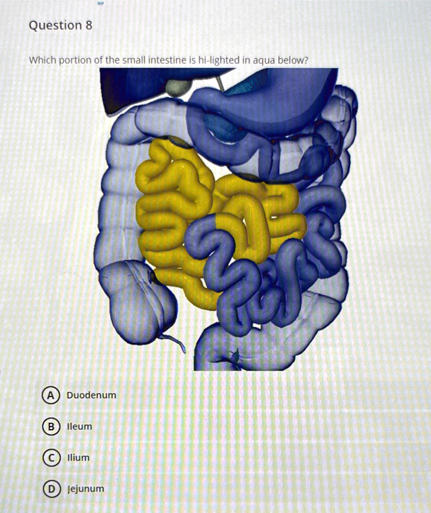 SOLVED: Question 8 Which portion of the small intestine is highlighted ...