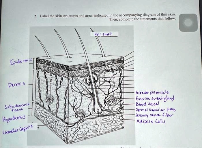 SOLVED: Epidermis Dermis Subcutaneous tissue Hypodermis Lamellar ...