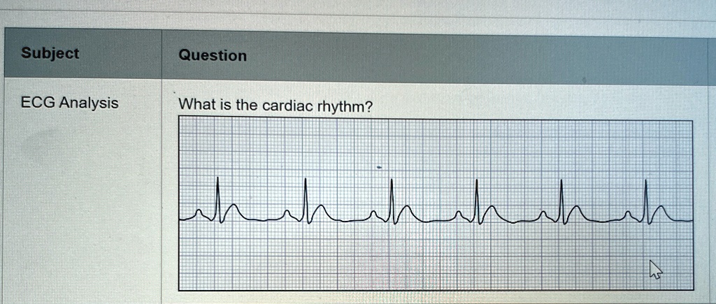 question ecg analysis what is the cardiac rhythm subject ecg analysis question what is the cardiac rhythm 31112