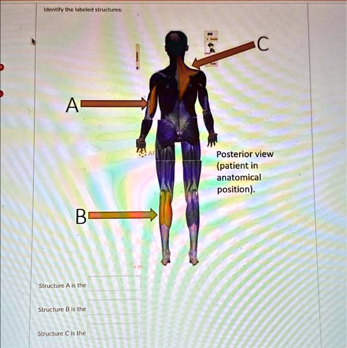 SOLVED: Identify the labeled structures: A B Structure A is the ...