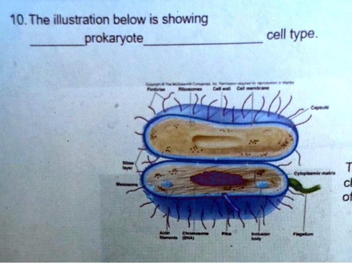 solved-10-the-illustration-below-is-showing-prokaryote-cell-type