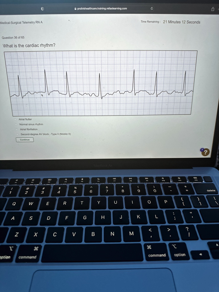 Medical Surgical Telemetry Rn A Question 36 Of 65 What Is The Cardiac Medical Surgical Telemetry Rn A Question 36 Of 65 What Is The Cardiac