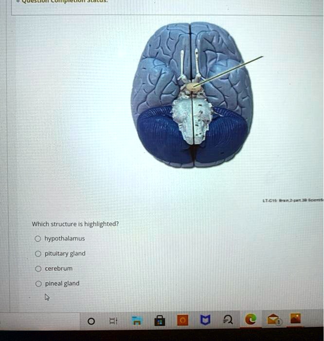 Which Structure Is Highlighted Pineal Gland SOLVED: Which structure is highlighted? Hypothalamus Pituitary gland