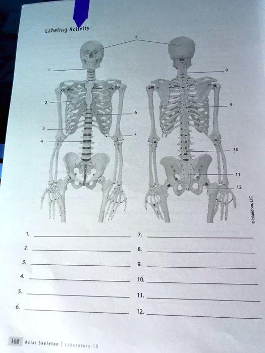 SOLVED: BIOL 2101 - Lab 10: Axial Skeleton The Skeleton - Labeling ...