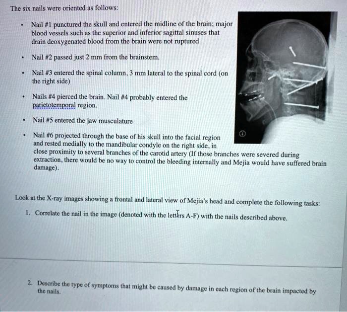 SOLVED: The six nails were oriented as follows: Nail #1 punctured the ...