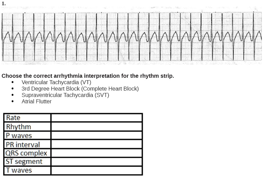 SOLVED: 'Choose the correct arrhythmia interpretation for the rhythm ...