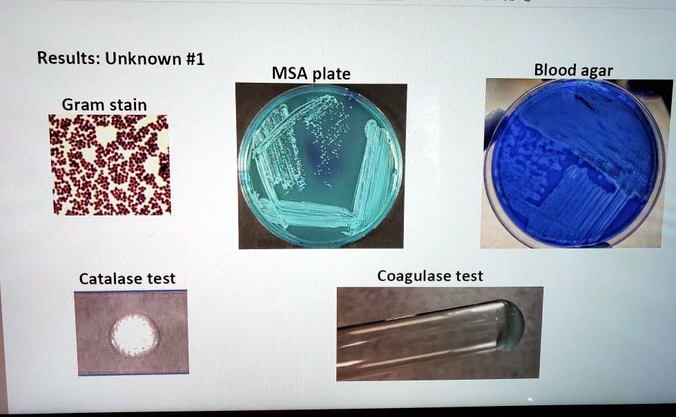 SOLVED: Results: Unknown #1 MSA plate Blood agar Gram stain Catalase ...