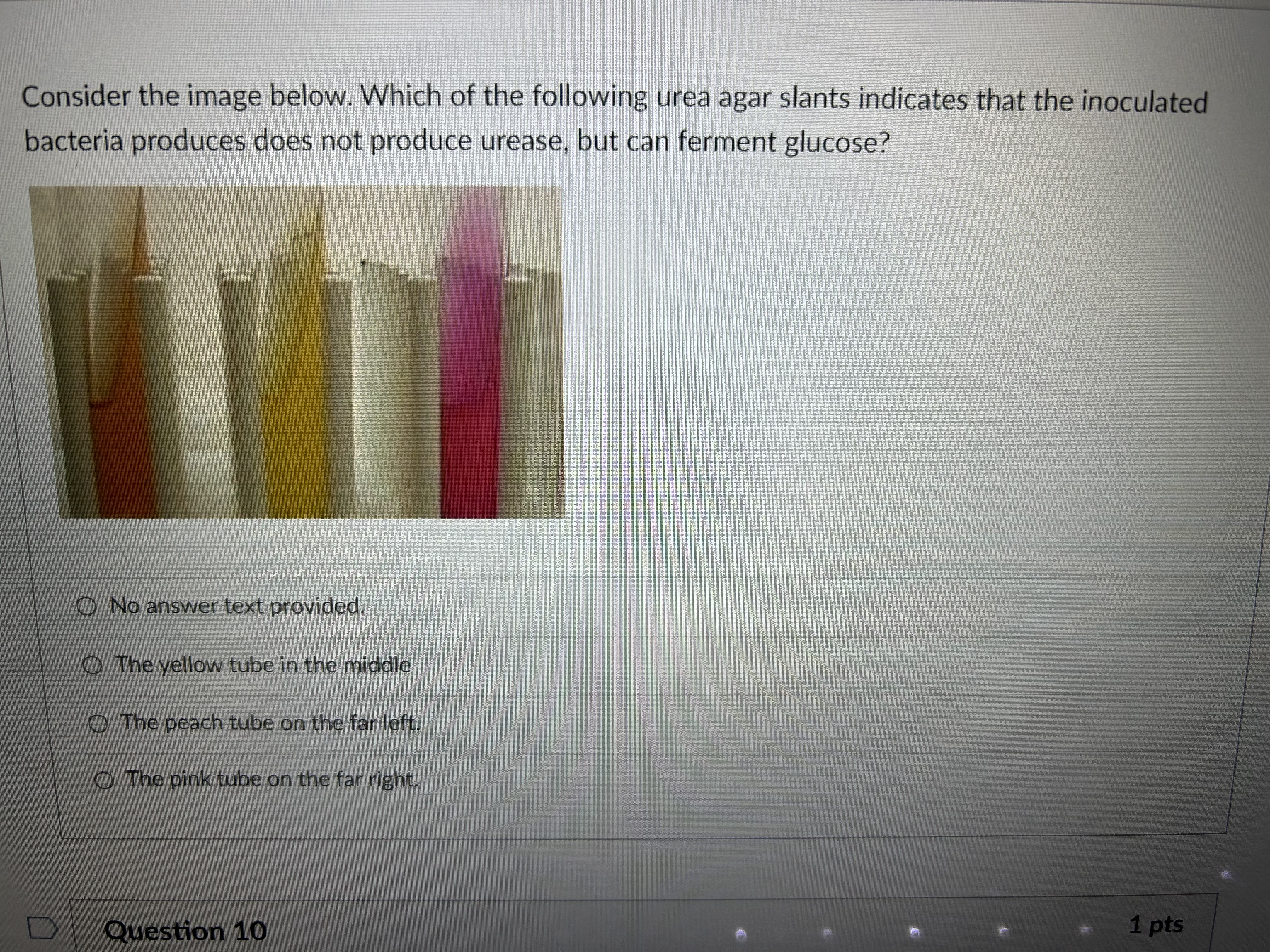consider the image below which of the following urea agar slants ...