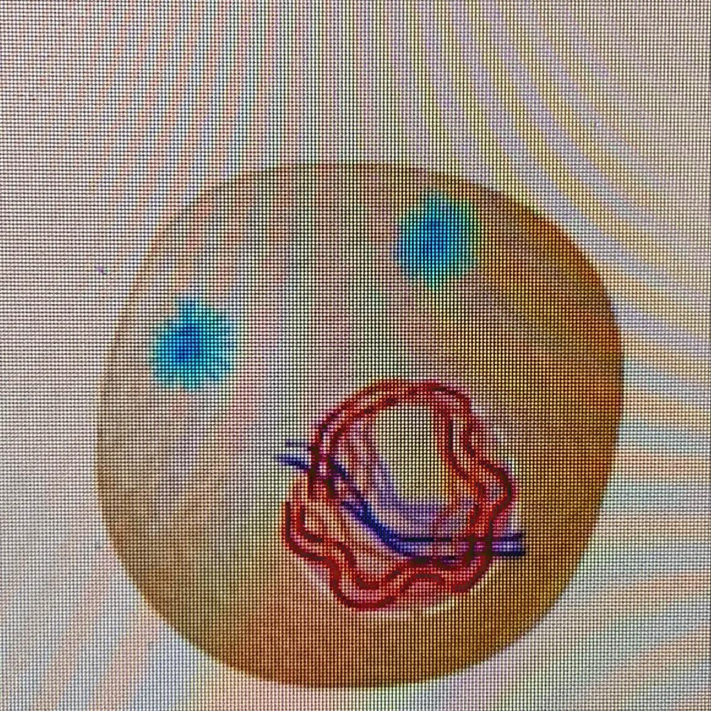 Solved Which Phase Of Cell Division Is Shown Prophase Anaphase