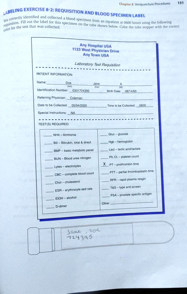 SOLVED Text Chapter Venipuncture Procedures 151 LABELING EXERCISE 82