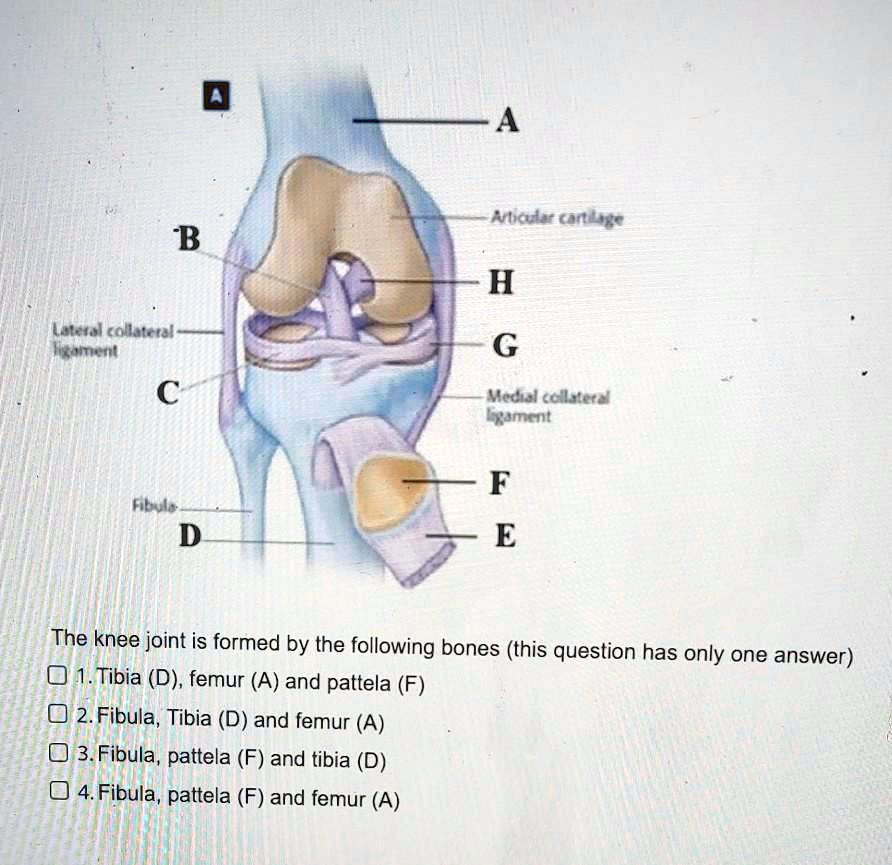 SOLVED: Articular cartilage Lateral collateral ligament Medial ...