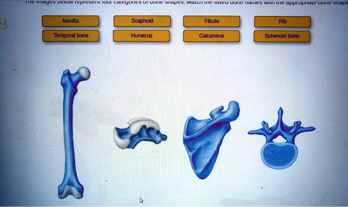 SOLVED: Siau Maxilla Scaphoid Fibula Rib Temporal bone Humerus ...