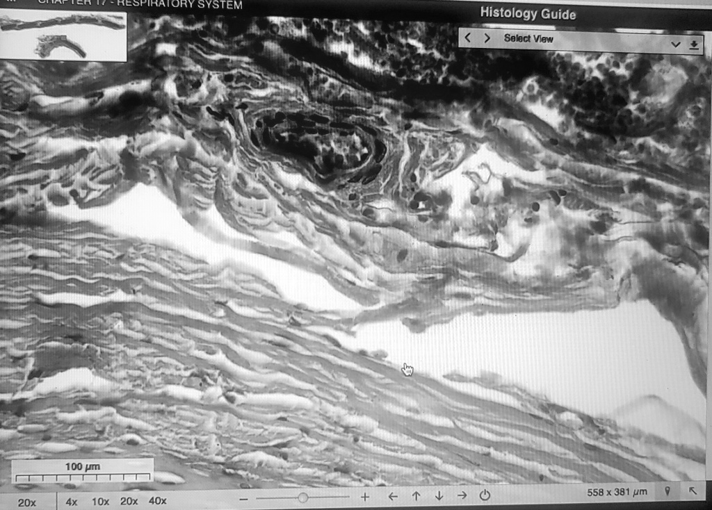 SOLVED: Trachea Label the image pointing to: - Type of epithelium ...