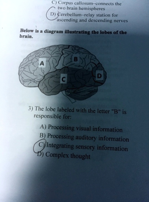 SOLVED Corpus callosum connects the two brain hemispheres Cerebellum