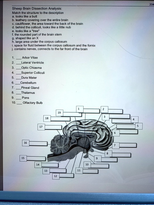 Sheep Brain Dissection Analysis:
Match the structure to the description
a. looks like a butt
b. leathery covering over the entire brain
c. cauliflower, the area toward the back of the brain
d. behind the colliculi, looks like a little nub
e. looks like a "tree"
f. the rounded part of the brain stem
g. shaped like an X
h. large area under the corpus callosum
i. space for fluid between the corpus callosum and the fornix
j. contains nerves, connects to the far front of the brain
1. Arbor Vitae
2. Lateral Ventricle
3. Optic Chiasma
4. Superior Colliculi
5. Dura Mater
6. Cerebellum
7. Pineal Gland
8. Thalamus
9. Pons
10. Olfactory Bulb