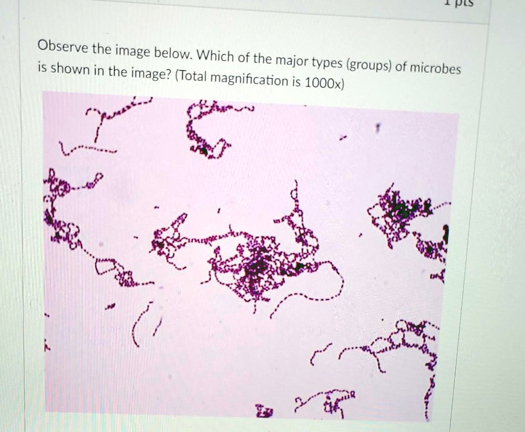 Microbiology 1. Please Observe the image below Which of the major