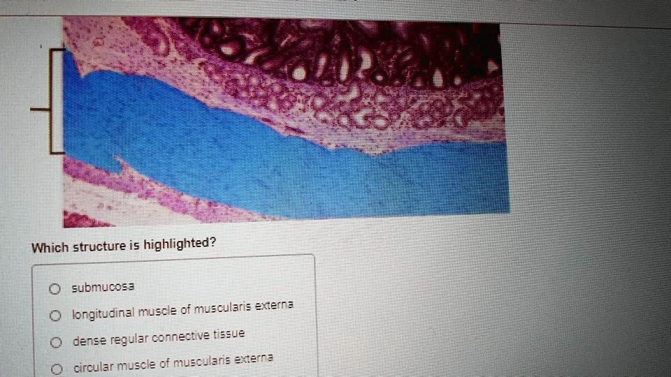 SOLVED: Which structure is highlighted? submucosa O longitudinal muscle ...