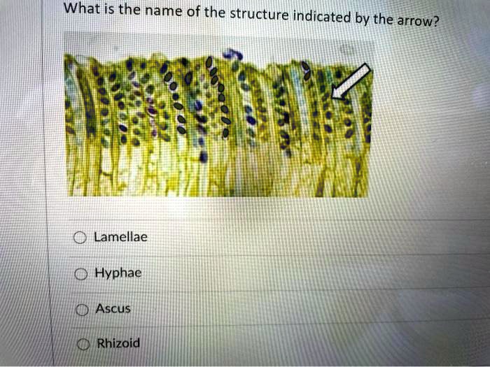 solved-what-is-the-name-of-the-structure-indicated-by-the-arrow