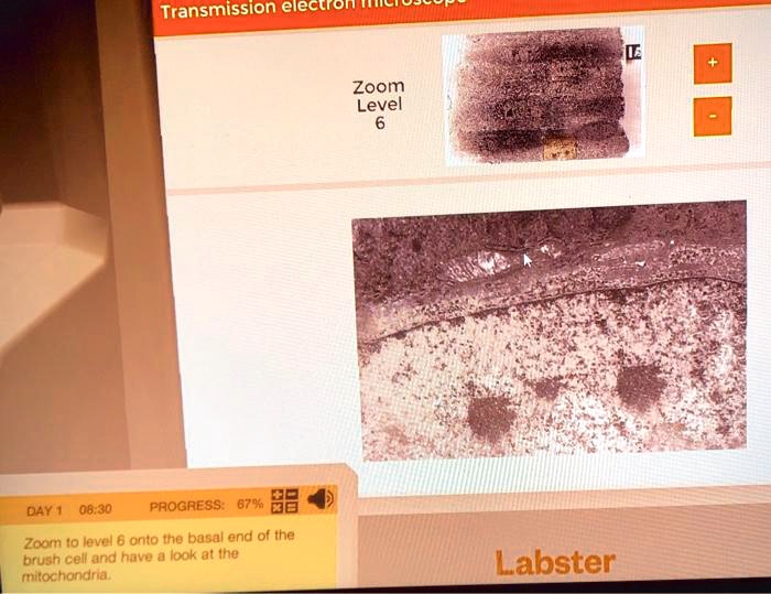 SOLVED Transmission electron Zoom Level Day 1 0830 PROGRESS 8790 Zoom