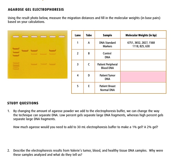 SOLVED: AGAROSE GEL ELECTROPHORESIS Using the result photo below ...