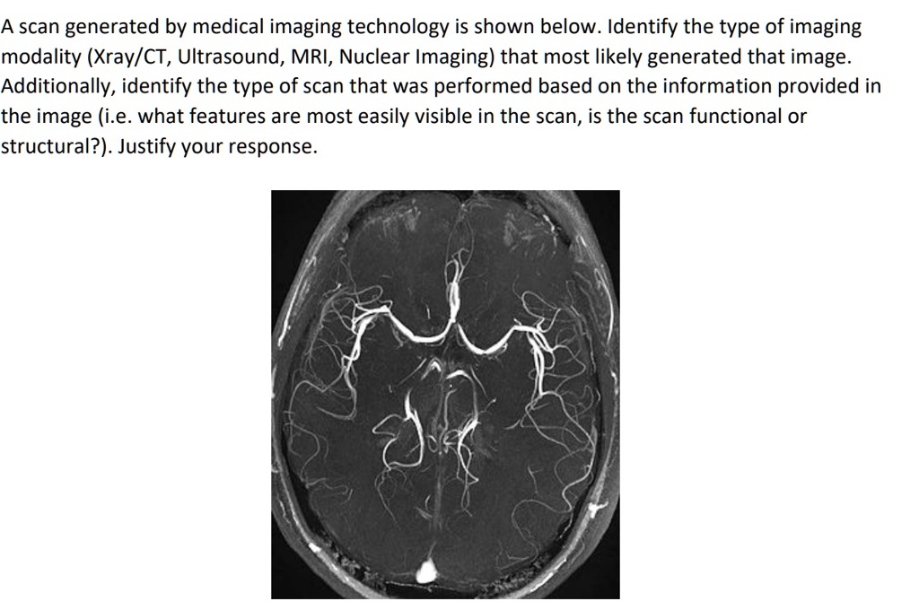 A scan generated by medical imaging technology is shown below. Identify the type of imaging modality (Xray/CT, Ultrasound, MRI, Nuclear Imaging) that most likely generated that image. Additionally, identify the type of scan that was performed based on the information provided in the image (i.e. what features are most easily visible in the scan, is the scan functional or structural?). Justify your response.