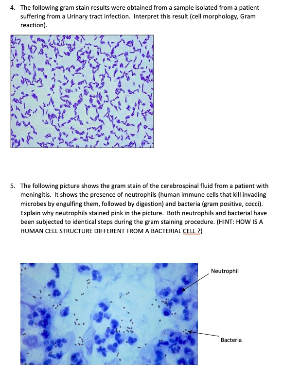 SOLVED The following gram stain results were obtained from sampl