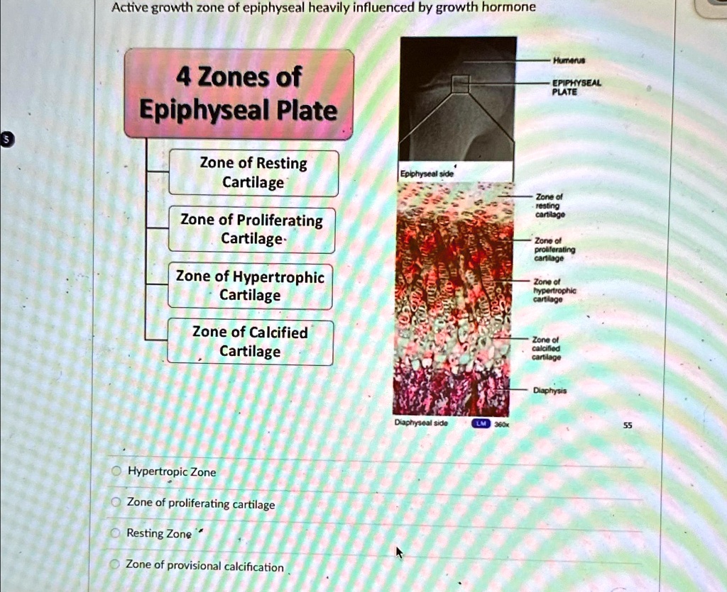 SOLVED Active growth zone of epiphyseal heavily influenced by growth