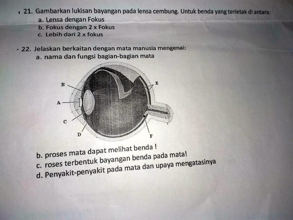 SOLVED: Tolong Dijawab Ya Kak 21. Gambarkan Lukisan Bayangan Pada Lensa ...