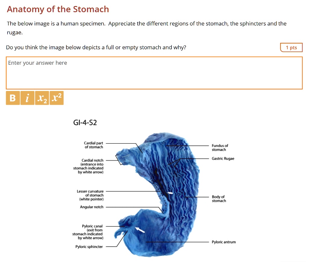 Anatomy of the Stomach The below image is a human specimen. Appreciate ...