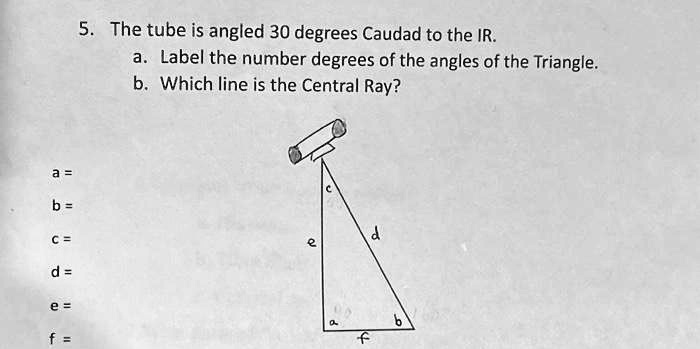 a = 
b = 
c = 
d = 
e = 
f = 
5. The tube is angled 30 degrees Caudad to the IR.
a. Label the number degrees of the angles of the Triangle.
b. Which line is the Central Ray?