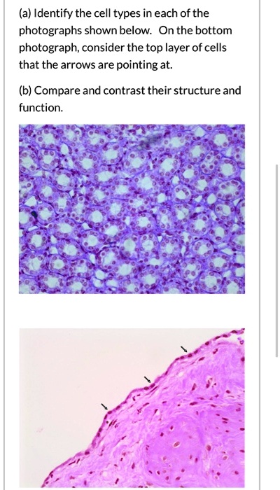 (a) Identify the cell types in each of the photographs shown below. On the bottom photograph, consider the top layer of cells that the arrows are pointing at.

(b) Compare and contrast their structure and function.