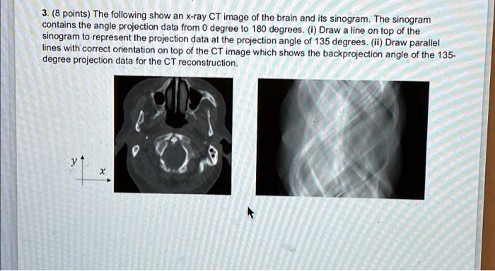 SOLVED: 3.8 points. The following shows an x-ray CT image of the brain ...