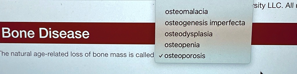 bone disease osteomalacia osteogenesis imperfecta osteodysplasia osteopenia the natural age related loss of bone mass is called osteoporosis .5927
