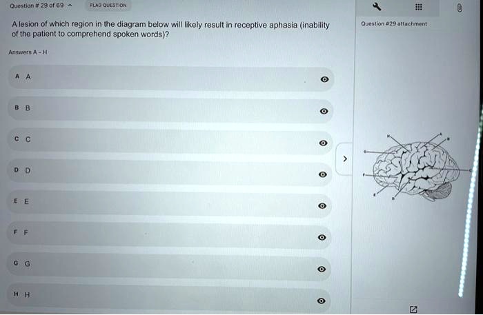 A lesion of which region in the diagram below will likely result in receptive aphasia (inability of the patient to comprehend spoken words)?
Answers A - H
A A
B B
C C
D D
E E
F F
G G
H H